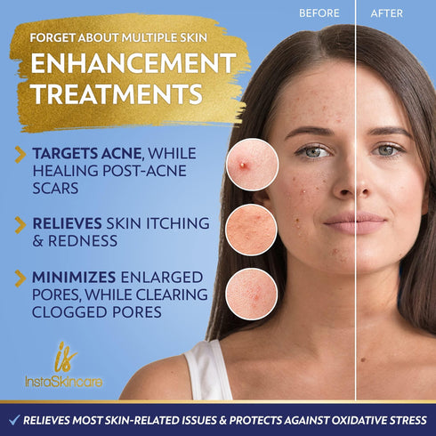 DOUBLE SIZED (2Oz) Niacinamide Serum for Face 10% with Zinc 1% Vitamin